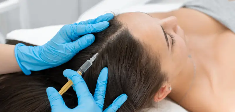 Tratamiento capilar regenerativo administrado en nuestra clínica IMCEP